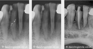 Dental Case Gallery